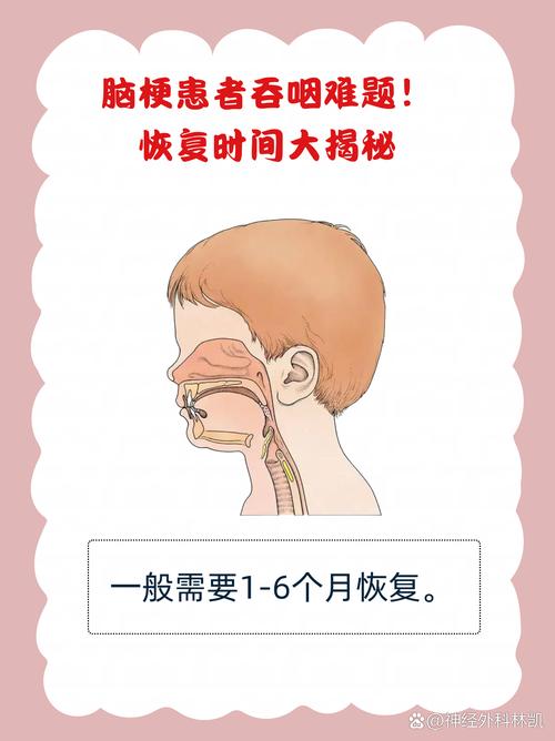 脑梗不能吞咽能恢复吗