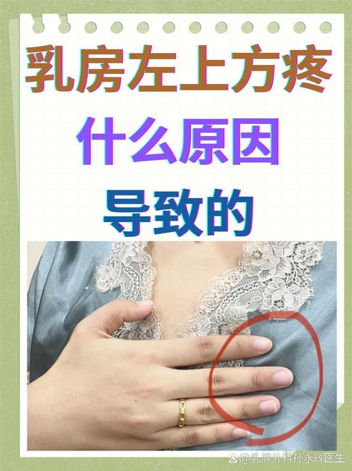 类风湿会引起乳房疼吗