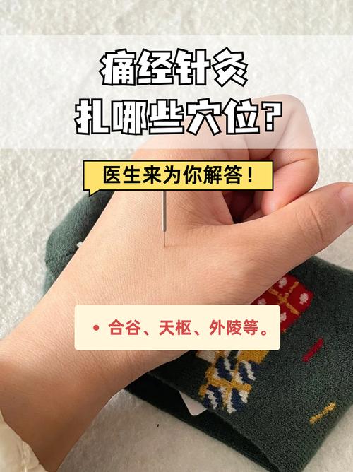 痛经实证的针灸穴位