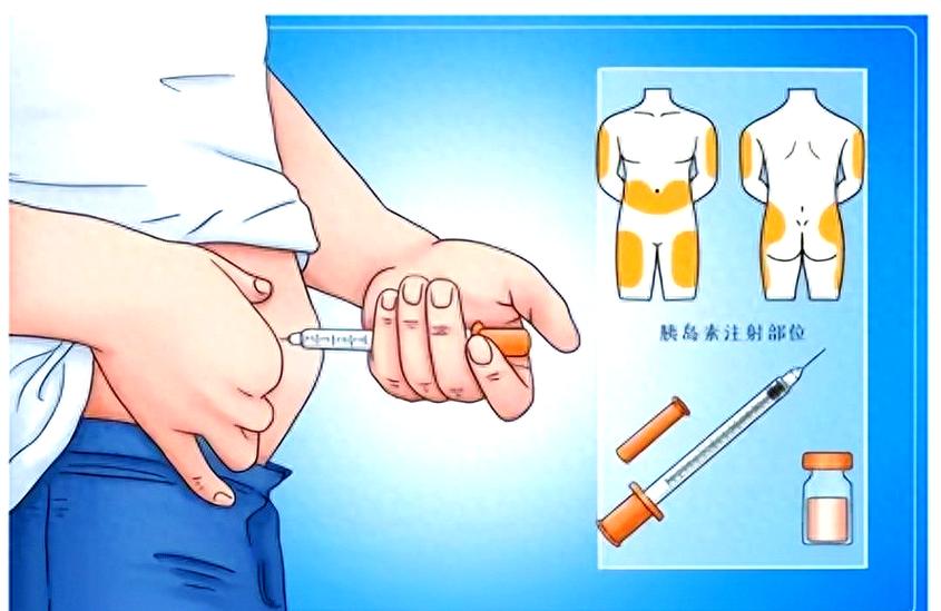 肌张力增高穴位注射