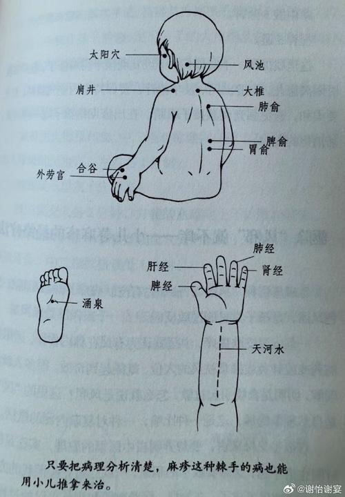 宝宝寻麻疹穴位按摩