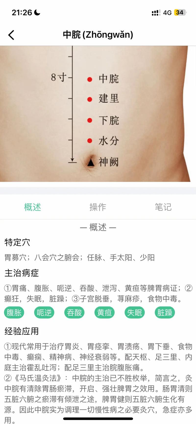 胃痛按哪个穴位缓解