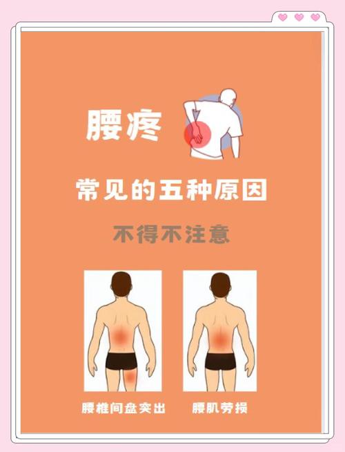 风湿性腰疼是什么症状