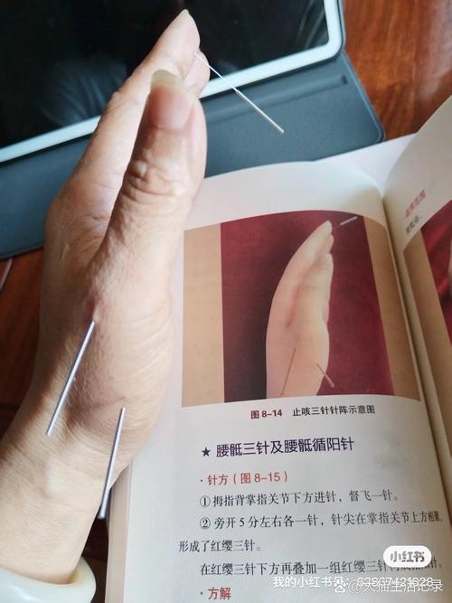 治疗类风湿要打什么针