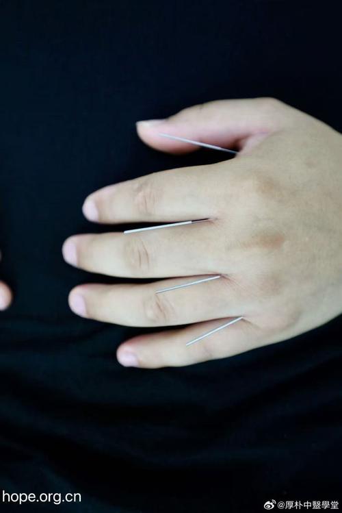 治疗类风湿要打什么针