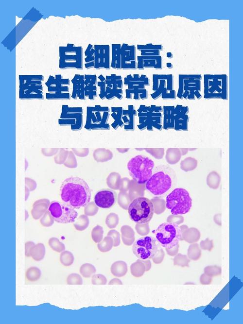 风湿会引起白细胞高吗