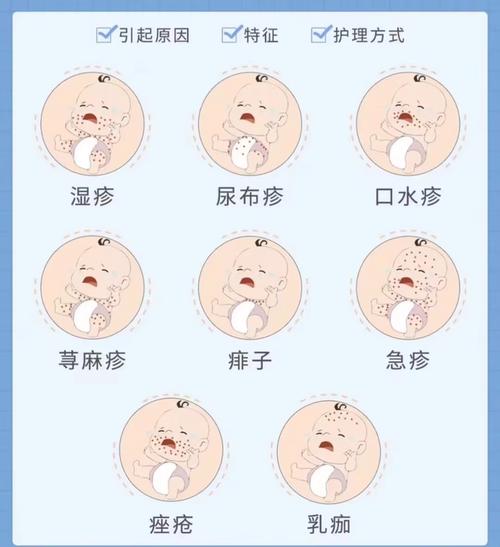 孩子出风湿疙瘩怎么办