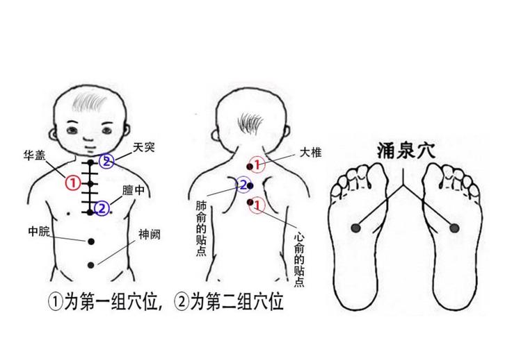 孩子高烧贴哪个穴位