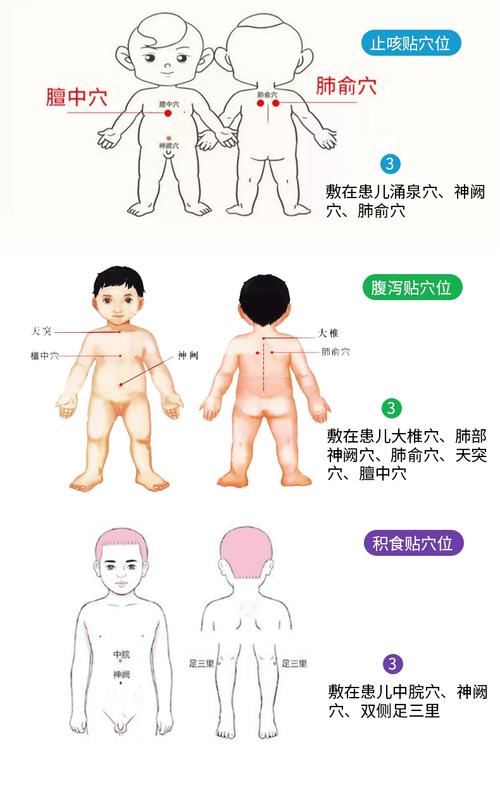 孩子高烧贴哪个穴位