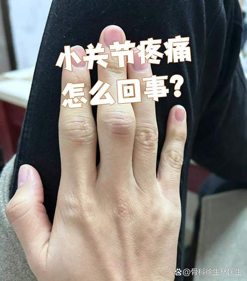 手指关节疼痛是风湿吗