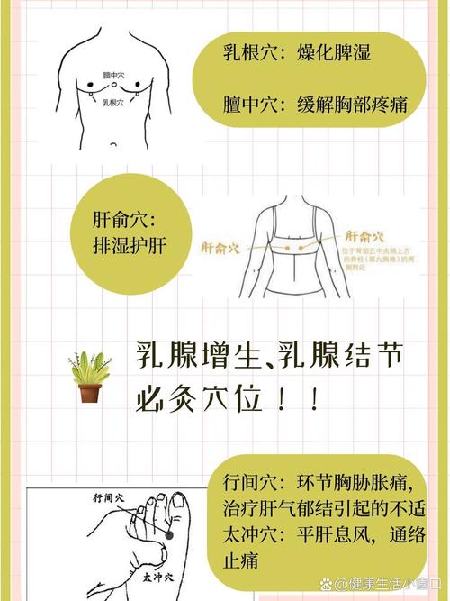 乳腺结节的穴位治疗