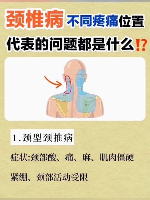 类风湿会引起颈椎疼么