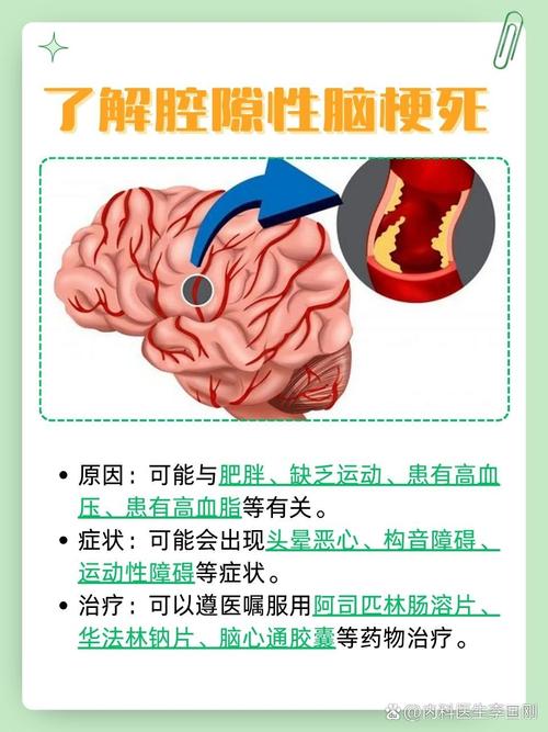 间隙性脑梗影响寿命吗