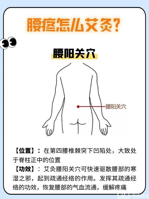 急性腰扭伤艾灸穴位