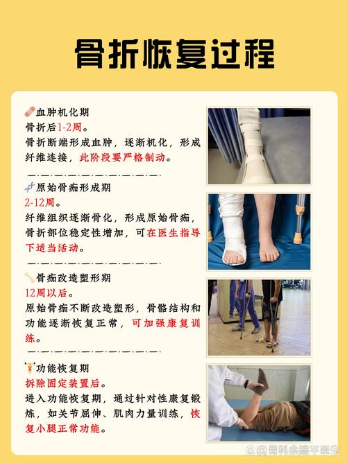 类风湿骨折后怎么治疗