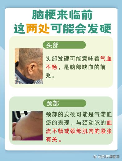 人突然失忆会是脑梗吗