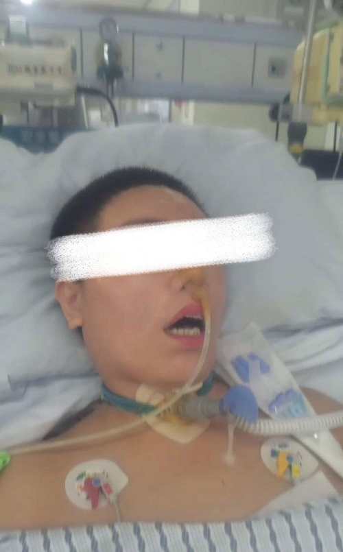 风湿心脏病手术严重吗