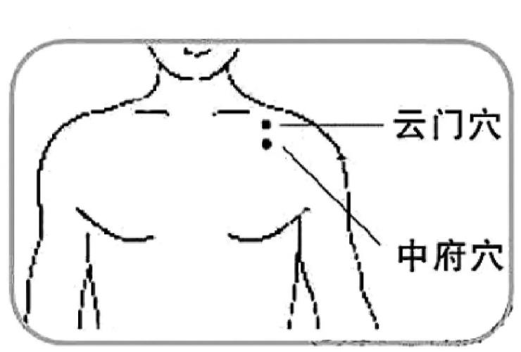 治疗咳嗽针灸穴位图
