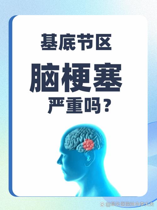 血小板低怎么还会脑梗