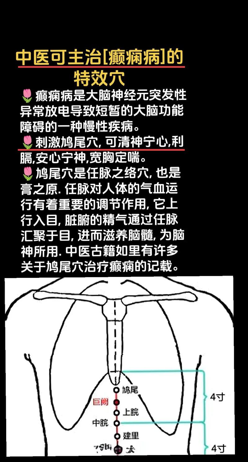 癫痫小发作穴位按摩
