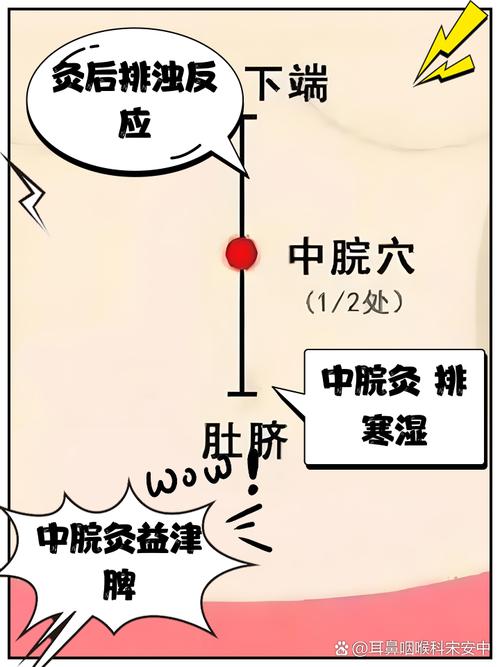 针灸治疗胃炎的穴位