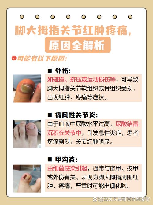 肾虚脚风湿肿痛怎么办