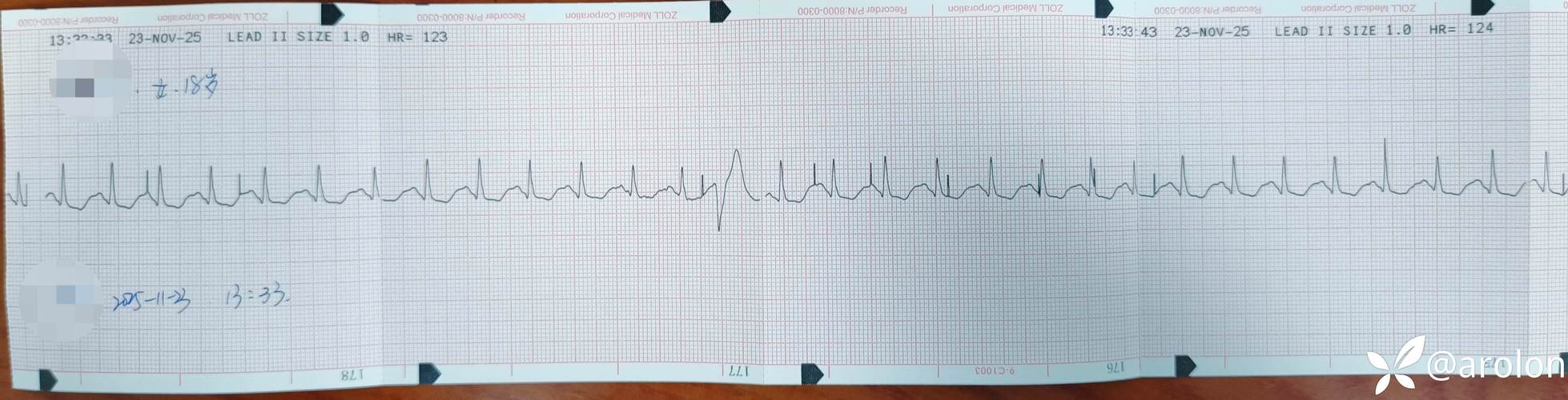 脑梗心跳117要紧吗
