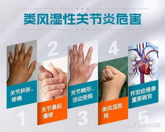 骄阳树液可以治风湿病