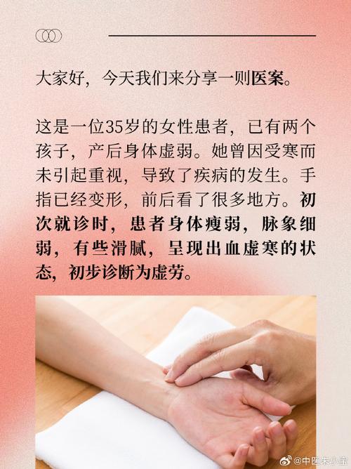 产后风湿有调理好的吗