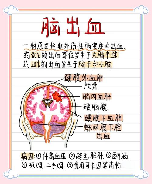 脑梗二次出血怎么回事