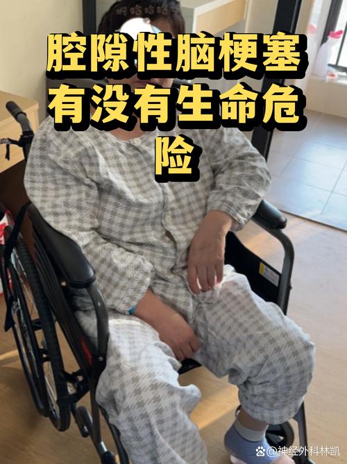 双侧多发腔隙性脑梗赛