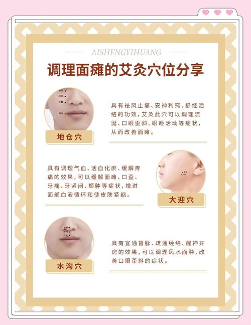 面瘫针灸要哪些穴位