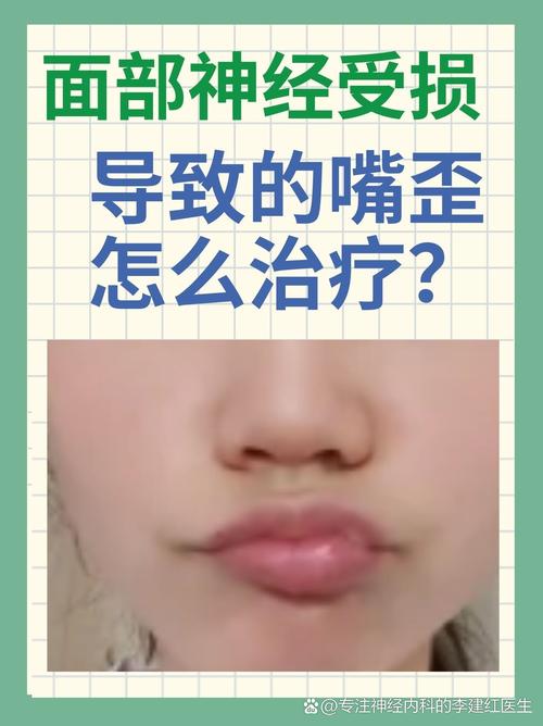 嘴突然歪可能是脑梗吗