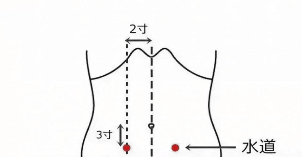 便秘火罐最佳穴位图