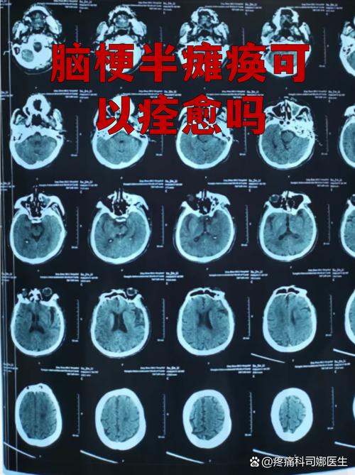 脑梗后遗症可以化疗吗