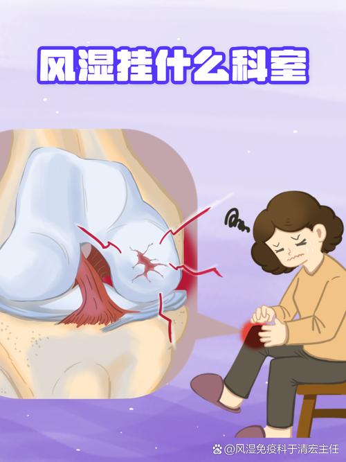 看有没有风湿挂什么科