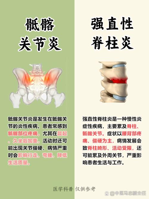 髋骨关节病是不是风湿