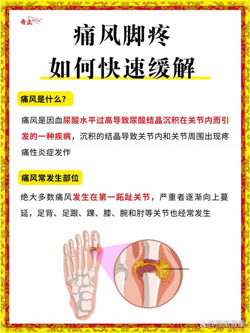 风湿脚肿痛怎么办土方