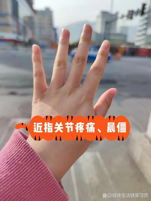 去医院查风湿要空腹吗