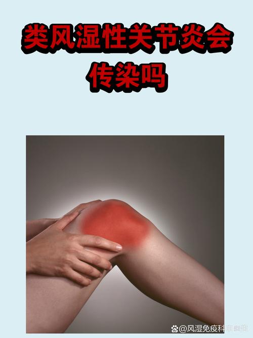 风湿性免疫疾病严重吗