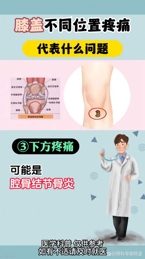 膝盖骨头疼是不是风湿