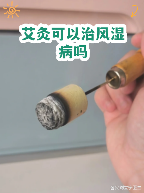 艾灸治疗风湿关节炎吗