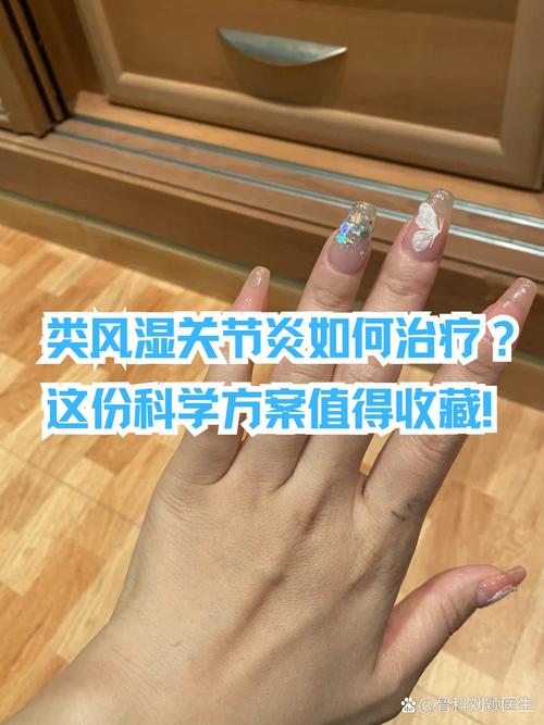 那家医院治风湿关节炎