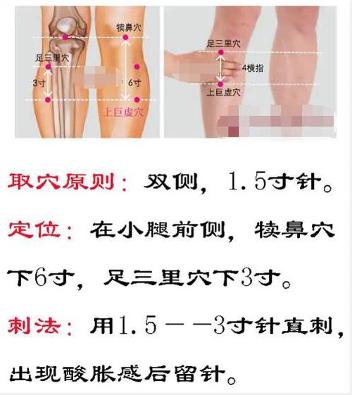 眩晕症针灸哪些穴位