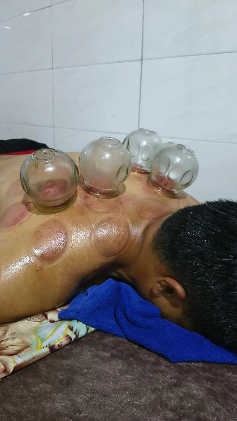 风湿肩周炎拔罐有用吗