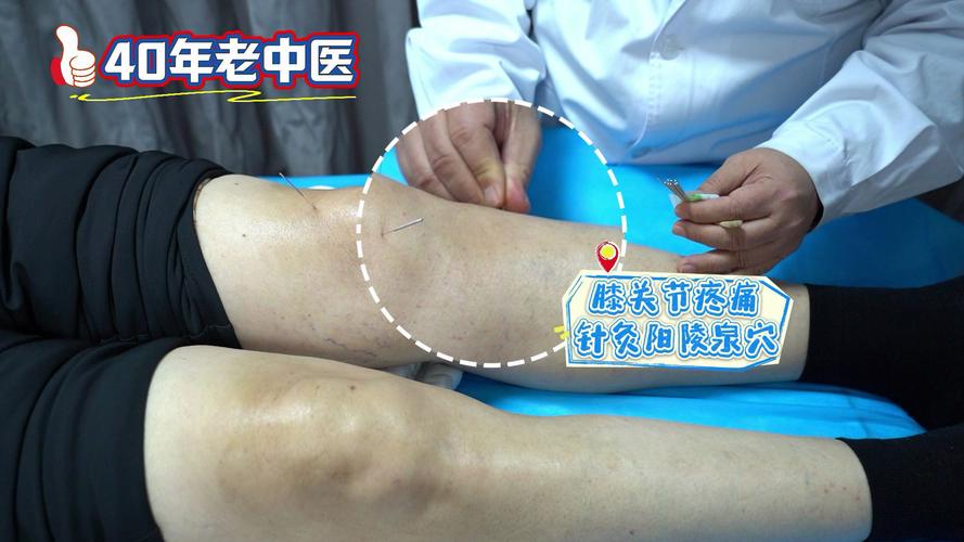 膝盖风湿用艾灸可以吗