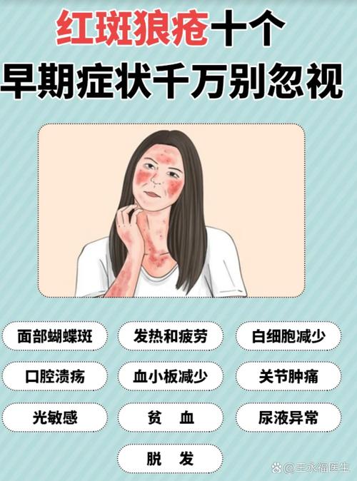 免疫风湿病有哪些症状