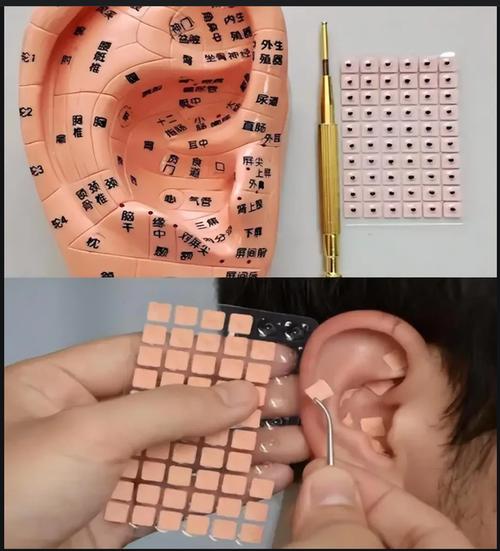 儿童耳针贴什么穴位