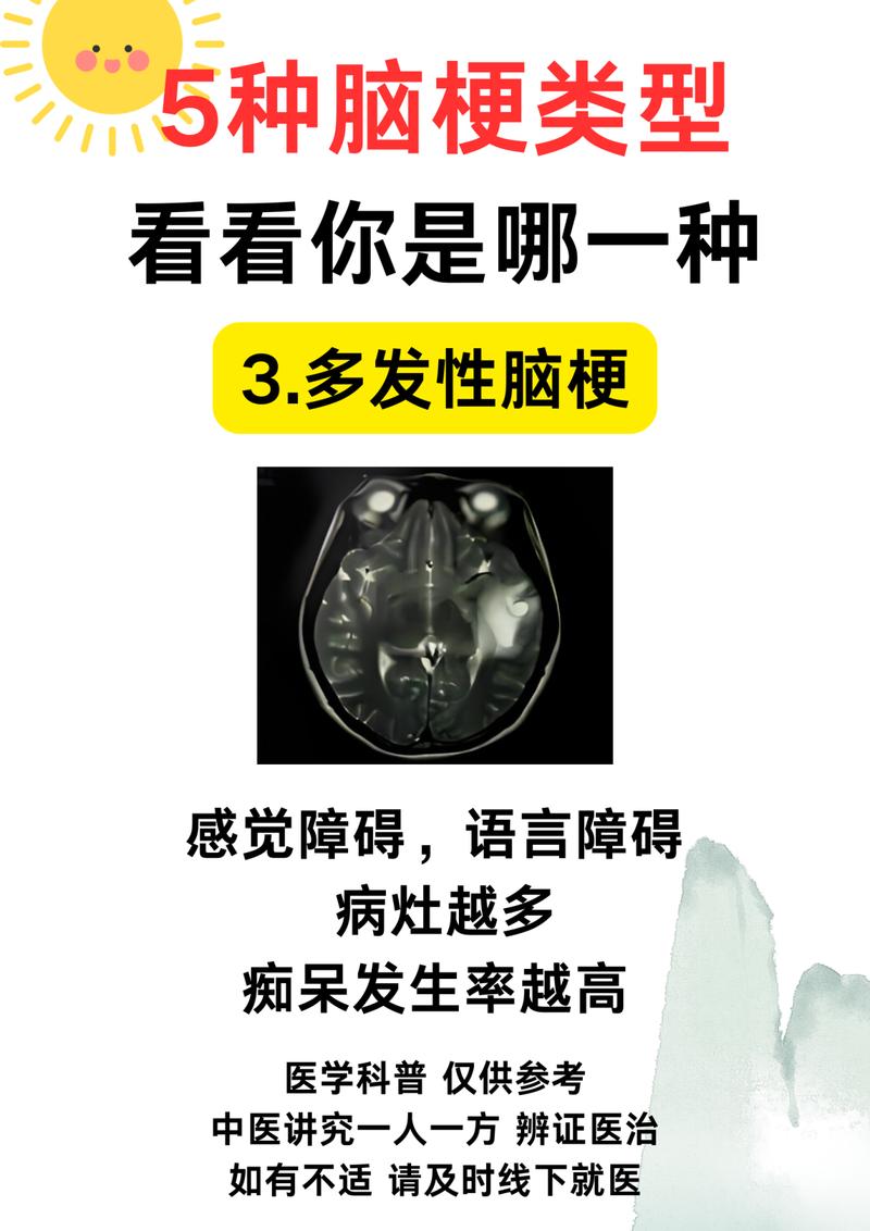 脑梗与脑血栓哪个严重