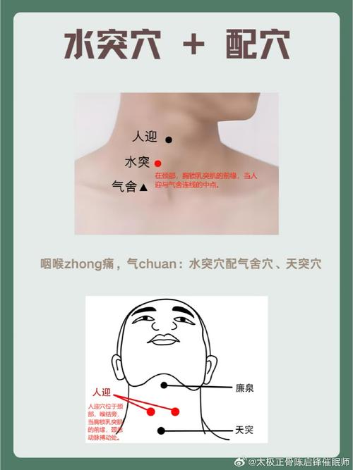 慢性咽炎有哪些穴位